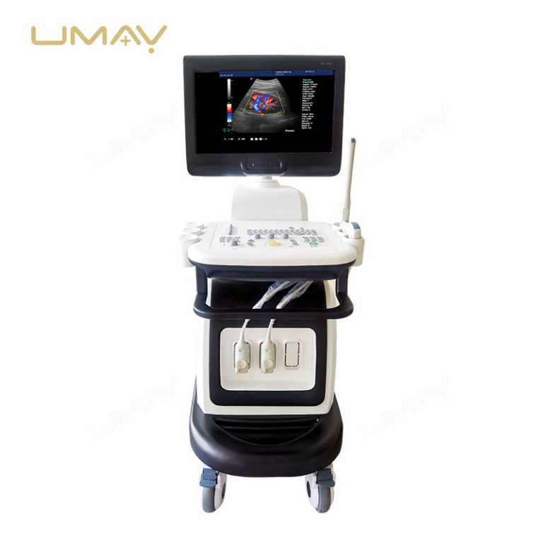 15 Inch High Definition Color Doppler Ultrasound Trolley with Elite Imaging