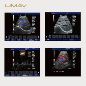 15 Inch High Definition Color Doppler Ultrasound Trolley with Elite Imaging-5