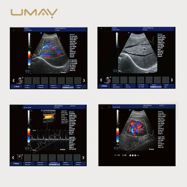 15 Inch High Definition Color Doppler Ultrasound Trolley with Elite Imaging-5