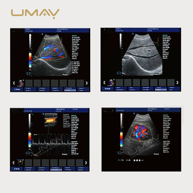 15 Inch High Definition Color Doppler Ultrasound Trolley with Elite Imaging