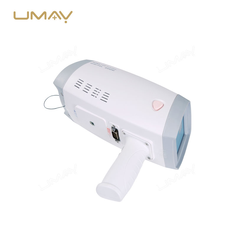 Convenient Handheld Digital Video Colposcope for Gynecological Diagnostics