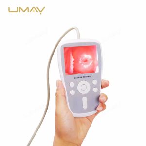 Handheld Digital Video Colposcope for Gynecological Diagnostics in Medical Settings-5