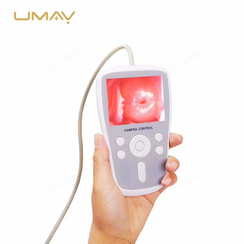 Convenient Handheld Digital Video Colposcope for Gynecological Diagnostics