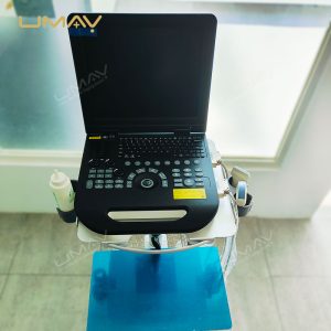 High-Quality Portable 3D Color Doppler Ultrasound Machine for Hospitals at Factory Price-5