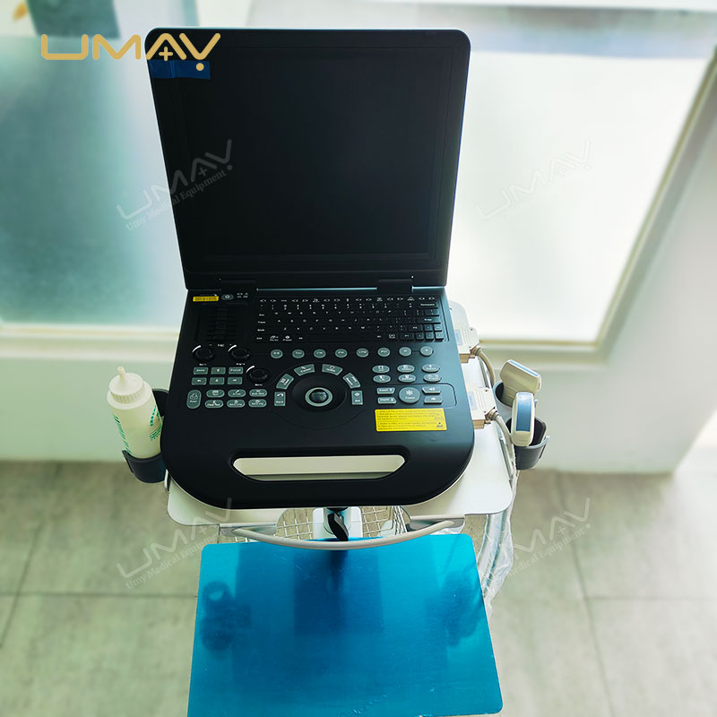 High-Quality Portable 3D Color Doppler Ultrasound Machine for Hospitals at Factory Price