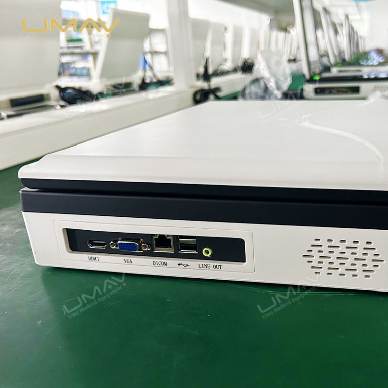 High-Quality Portable 3D Color Doppler Ultrasound Machine for Hospitals at Factory Price-7