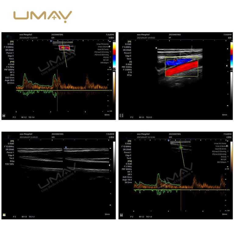 High-Quality Portable 3D Color Doppler Ultrasound Machine for Hospitals at Factory Price-8