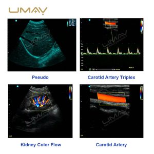 Portable 3D 4D Color Doppler Ultrasound Scanner for Obstetrics, Cardiology, and Abdominal Diagnostics-8