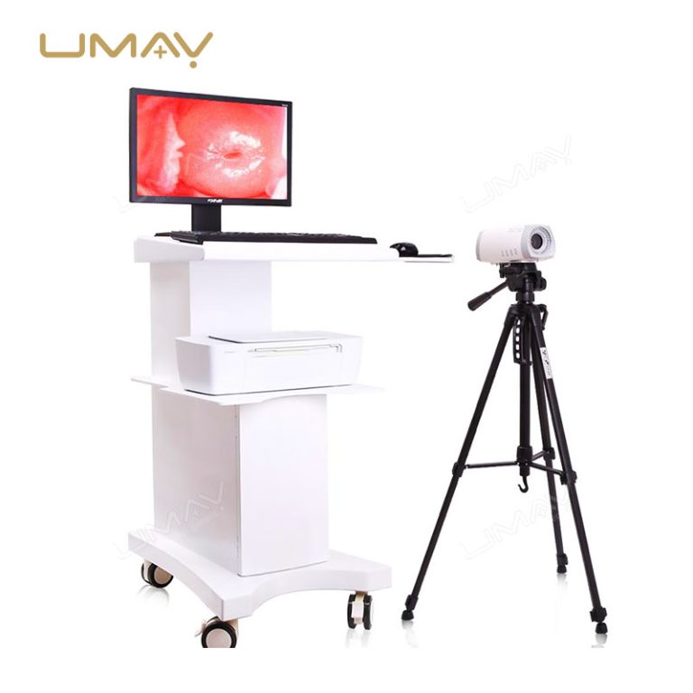 Trolley Video Colposcope System for Gynecological Examination and Cervical Screening