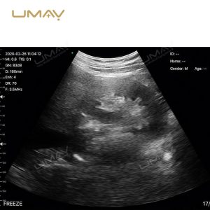 Wireless Ultrasound Probe with 128 Elements and Convex Scanner for Ultimate Clarity Imaging-2