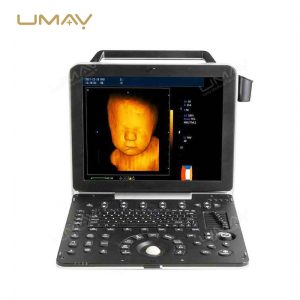 Go-To Option Portable Color Doppler Ultrasound Sonography Machine-2