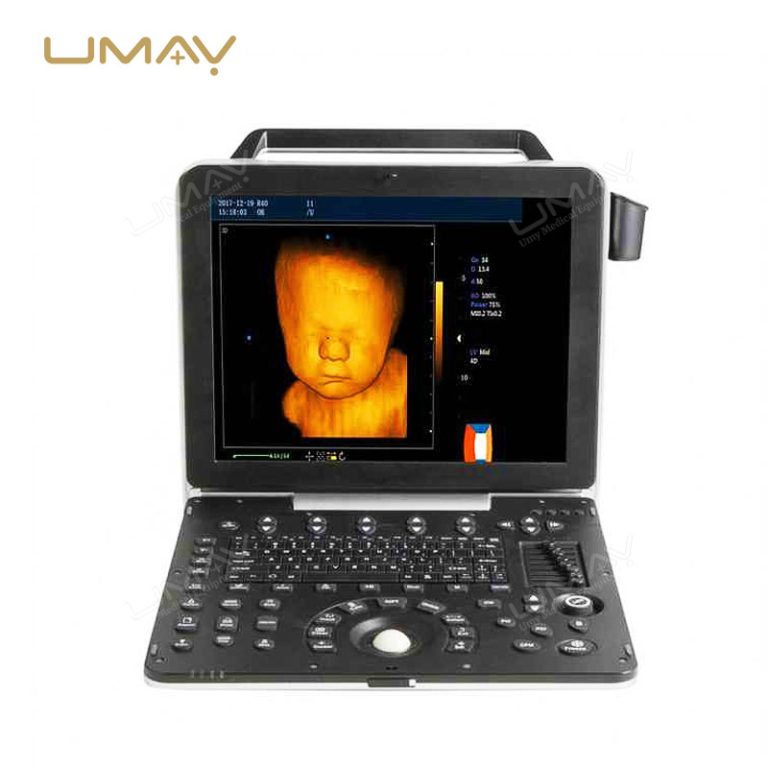 Go-To Option Portable Color Doppler Ultrasound Sonography Machine-2