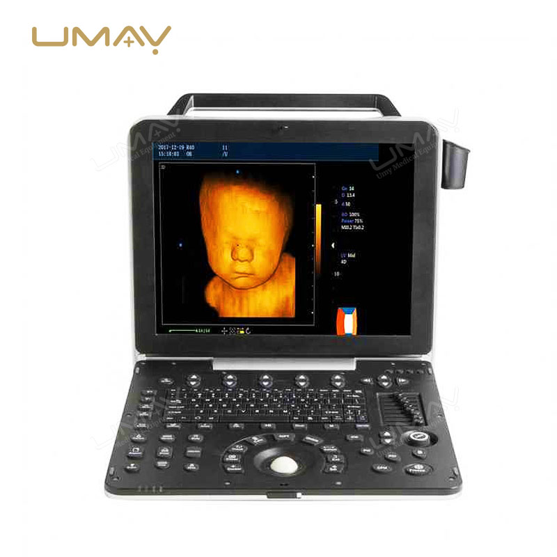 Go-To Option Portable Color Doppler Ultrasound Sonography Machine