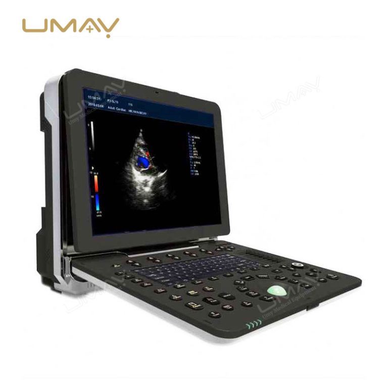 Go-To Option Portable Color Doppler Ultrasound Sonography Machine-3