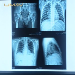 Smart Value Digital X Ray Film Inkjet Printer Medical DICOM Image Printer-2