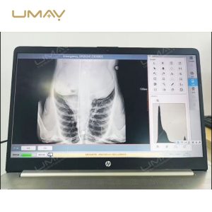 Smart Value Digital X Ray Film Inkjet Printer Medical DICOM Image Printer-8