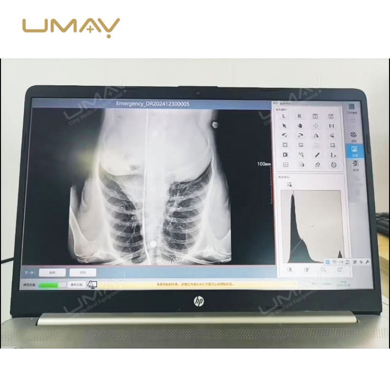Smart Value Digital X Ray Film Inkjet Printer Medical DICOM Image Printer-8