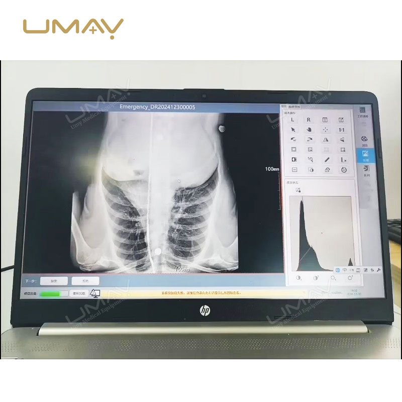 Smart Value Digital X Ray Film Inkjet Printer Medical DICOM Image Printer