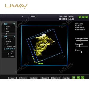 CE Approved 3D 4D Full Digital Trolley Doppler Ultrasound Scanner-9