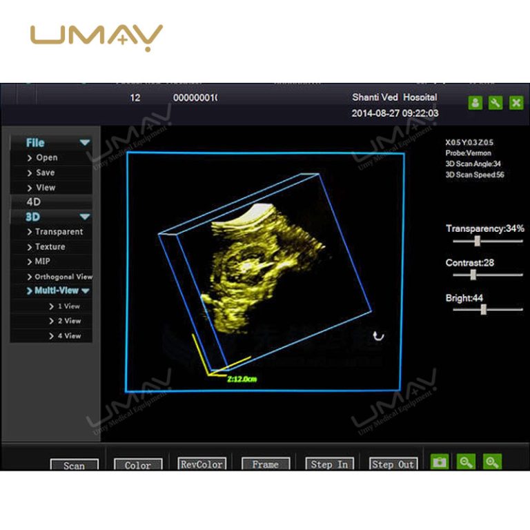 CE Approved 3D 4D Full Digital Trolley Doppler Ultrasound Scanner-9