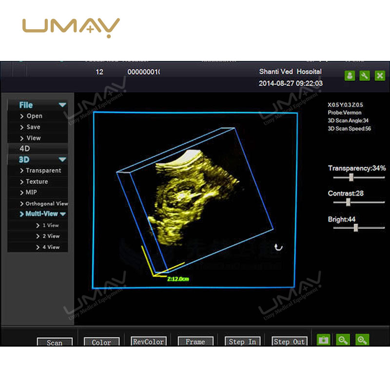 CE Approved 3D/4D Full Digital Trolley Doppler Ultrasound Scanner