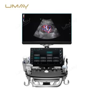 Consona N Series N8 N9 Color Doppler Ultrasound Systems for Hospital Imaging-6