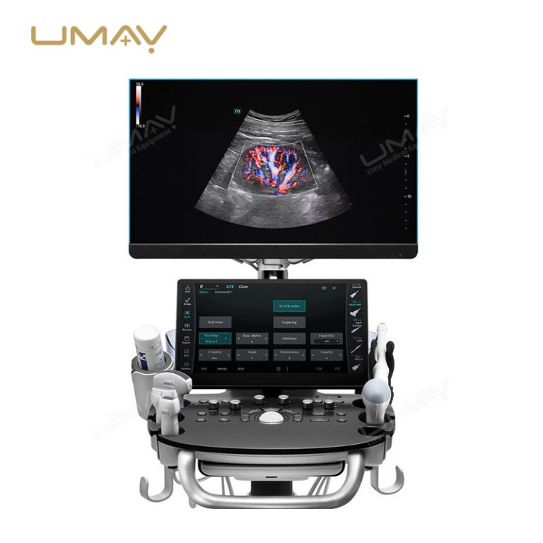Consona N Series N8 N9 Color Doppler Ultrasound Systems for Hospital Imaging-6