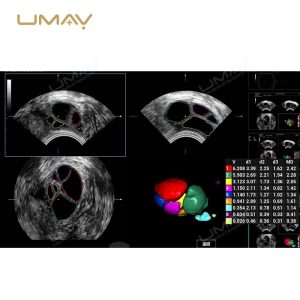 Consona N Series N8 N9 Color Doppler Ultrasound Systems for Hospital Imaging-7