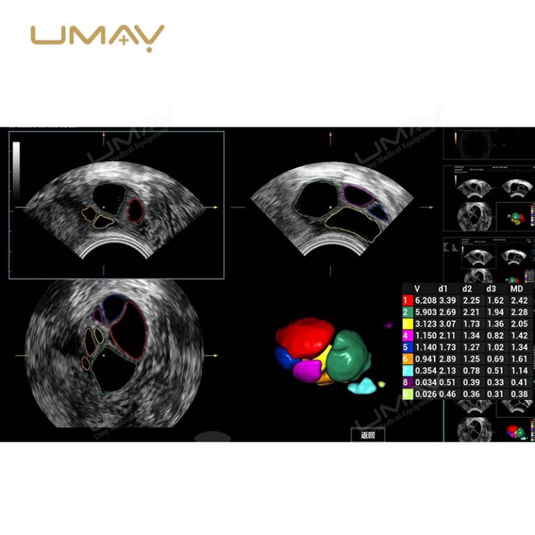 Consona N Series N8 N9 Color Doppler Ultrasound Systems for Hospital Imaging-7