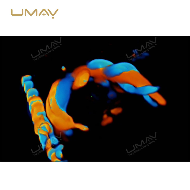 Consona N Series N8 N9 Color Doppler Ultrasound Systems for Hospital Imaging