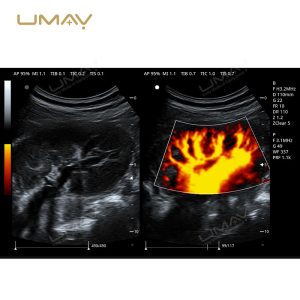Trolley 3D and 4D Color Doppler Ultrasound Machine for Fine-Detail Imaging-14