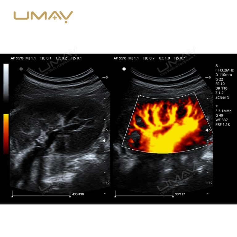 Trolley 3D and 4D Color Doppler Ultrasound Machine for Fine-Detail Imaging-14
