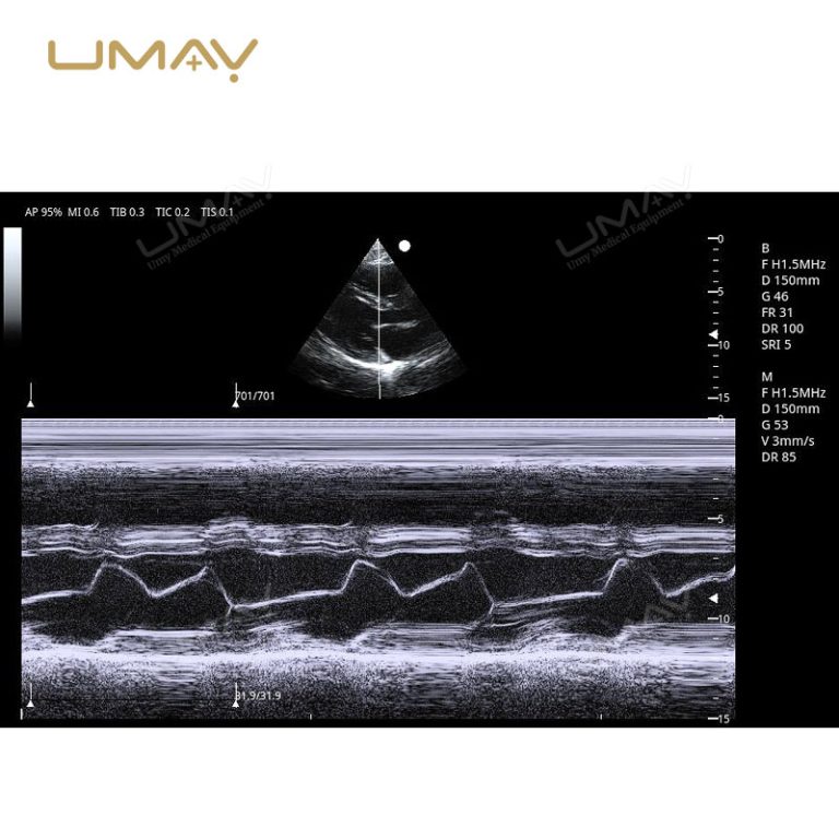 Trolley 3D and 4D Color Doppler Ultrasound Machine for Fine-Detail Imaging-15