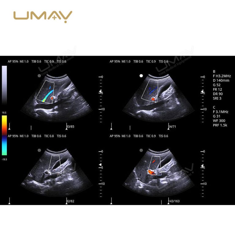 Trolley 3D and 4D Color Doppler Ultrasound Machine for Fine-Detail Imaging-16