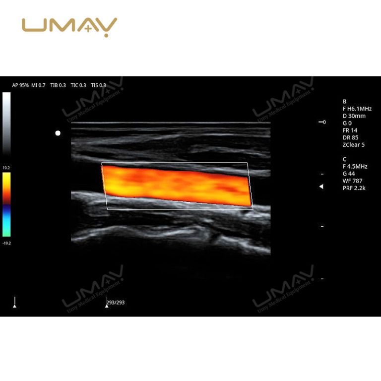 Trolley 3D and 4D Color Doppler Ultrasound Machine for Fine-Detail Imaging-19