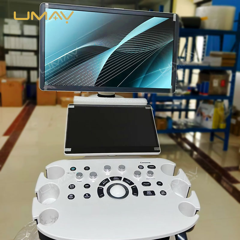 Consona N Series Diagnostic Ultrasound System N6 N7 with ZST Plus Imaging Platform