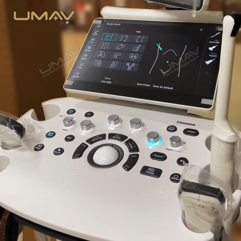 Consona N Series Diagnostic Ultrasound System N6 N7 with ZST Plus Imaging Platform