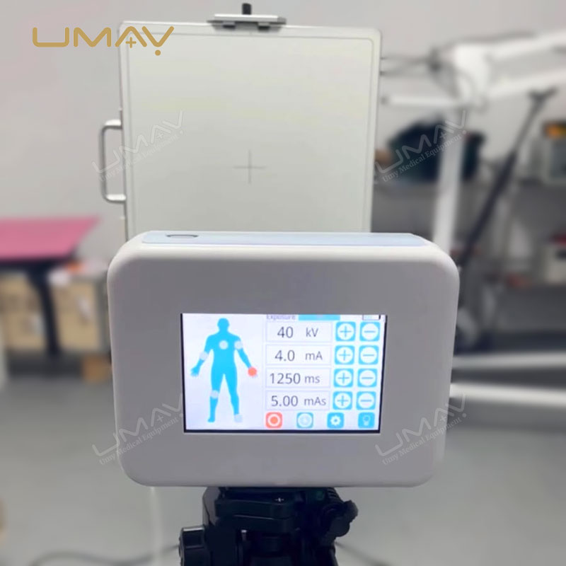 Handheld Human & Vet X Ray Machine Good for Emergency Medical Imaging