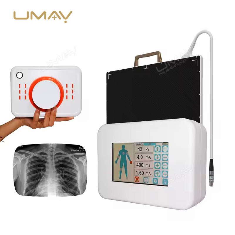 Handheld Human & Vet X Ray Machine Good for Emergency Medical Imaging