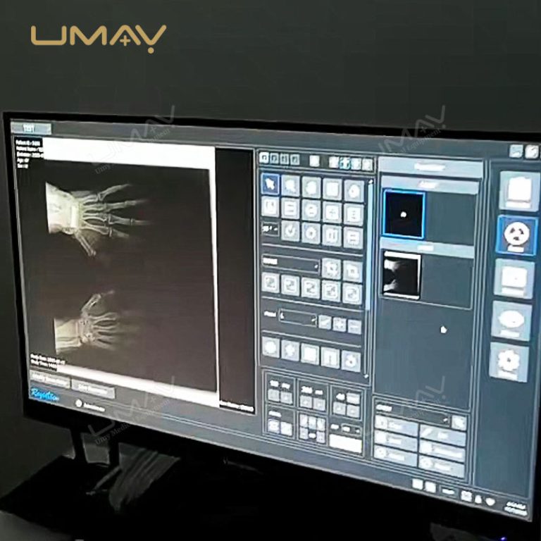 Handheld X Ray Source with Lightweight Design Similar to FUJIFILM-7