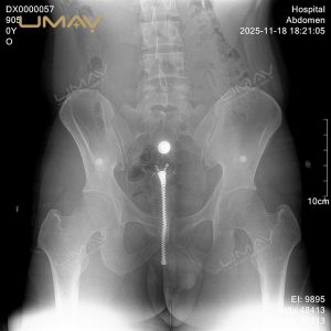 90kv Digital X-ray Machine with Low Radiation for Human and Vet Clinic and OEM-5