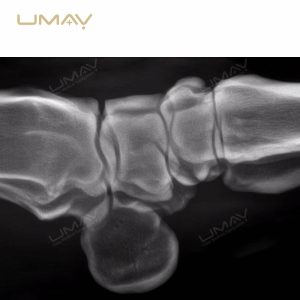 Portable 1kW Digital X Ray Machine with Touch Screen Control for Human and Vet Imaging-18