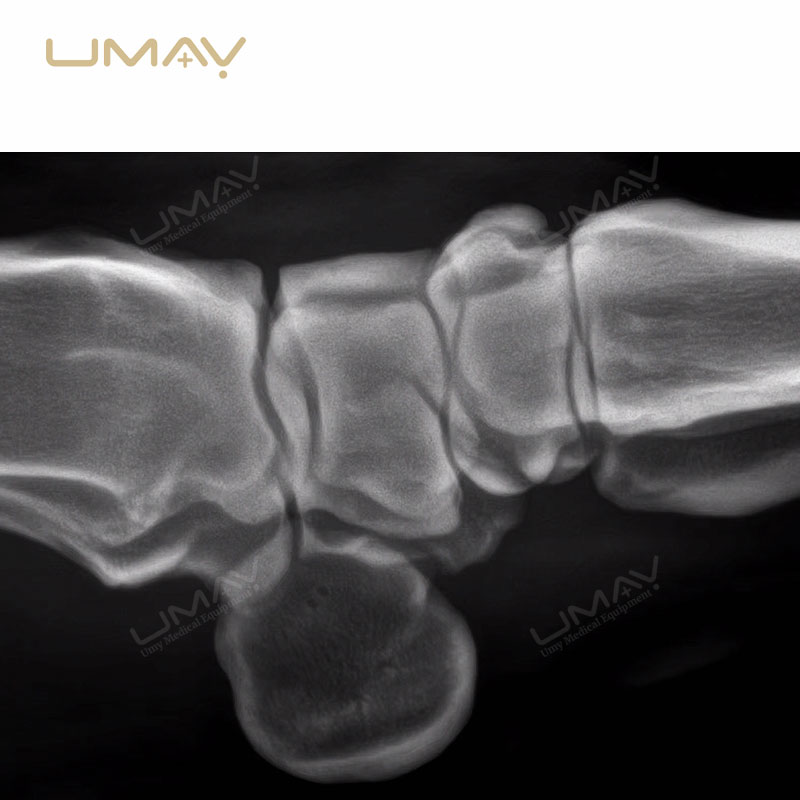 Portable 1kW Digital X Ray Machine with Touch Screen Control for Human and Vet Imaging