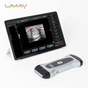Wireless Pocket Ultrasound Probe With 3 in 1 Linear Convex and Phased Array Scanning for Bedside Diagnostics-5