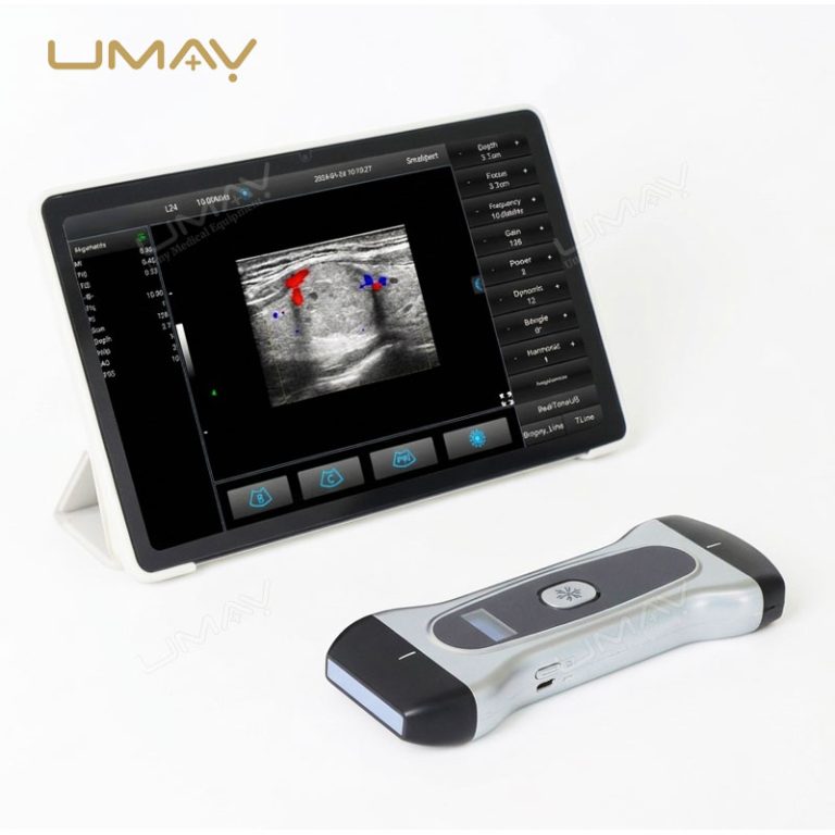 Wireless Pocket Ultrasound Probe With 3 in 1 Linear Convex and Phased Array Scanning for Bedside Diagnostics-5