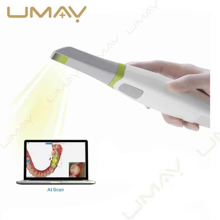 UMY intraoral scanner emitting a light beam next to a laptop screen showcasing an intelligent AI teeth scan.