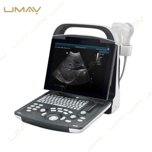 Compact Portable Diagnostic Ultrasound Scanner
