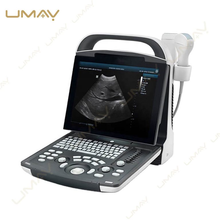 Portable diagnostic ultrasound system with attached imaging probe.
