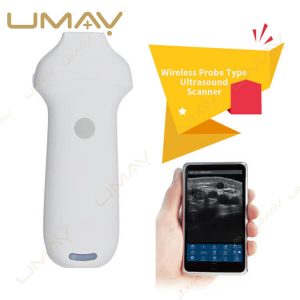Wireless Probe Type Ultrasound Scanner for Smartphone