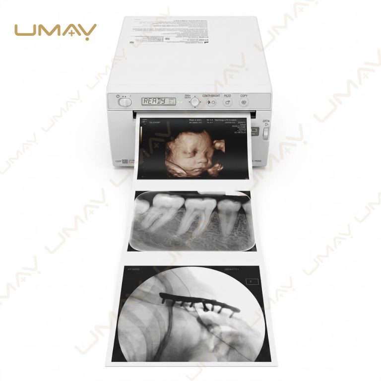 High Resolution Medical Ultrasound Print Sample